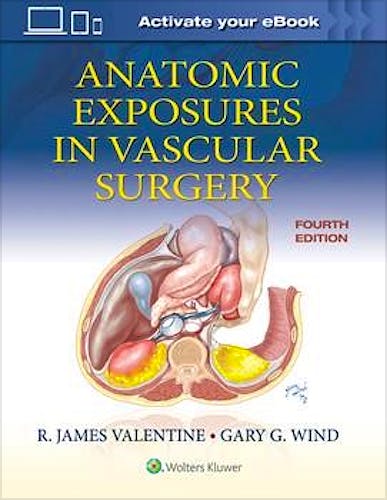 Portada del libro 9781975152765 Anatomic Exposures in Vascular Surgery