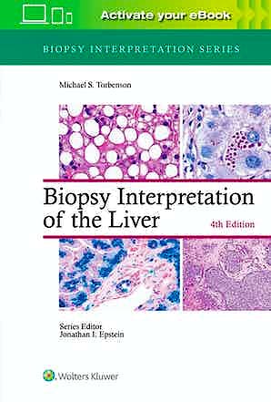 Portada del libro 9781975157296 Biopsy Interpretation of the Liver