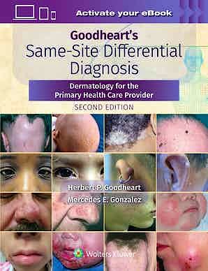 Portada del libro 9781975161330 GOODHEART's Same-Site Differential Diagnosis. Dermatology for the Primary Health Care Provider