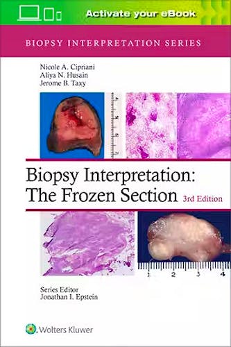 Biopsy Interpretation: the Frozen Section