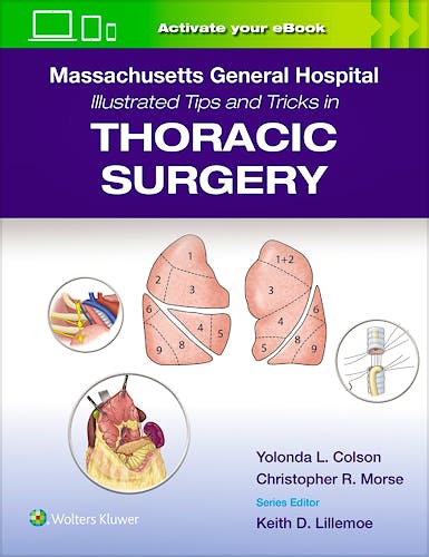 Portada del libro 9781975171933 MASSACHUSETTS GENERAL HOSPITAL Illustrated Tips and Tricks in Thoracic Surgery: Print + eBook with Multimedia