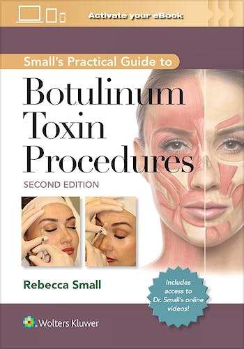 SMALL's Practical Guide to Botulinum Toxin Procedures
