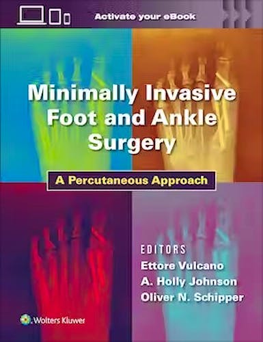 Minimally Invasive Foot and Ankle Surgery. A Percutaneous Approach