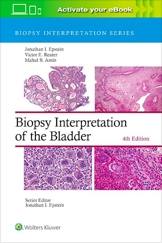 Portada del libro 9781975199203 Biopsy Interpretation of the Bladder