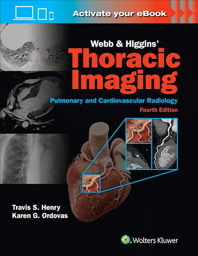 WEBB and HIGGINS' Thoracic Imaging. Pulmonary and Cardiovascular Radiology. Print + Ebook with Multimedia