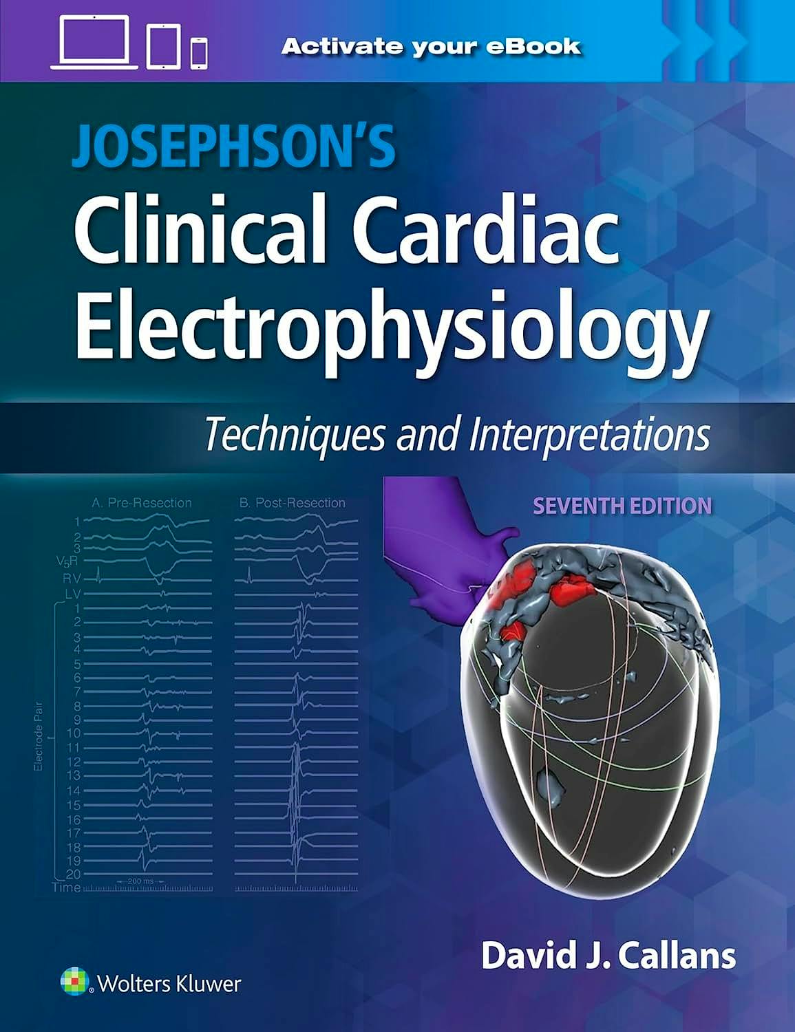 JOSEPHSON's Clinical Cardiac Electrophysiology. Techniques and