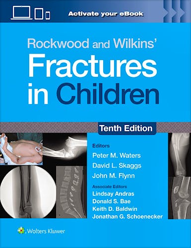 ROCKWOOD and WILKINS' Fractures in Children. Print + eBook with Multimedia