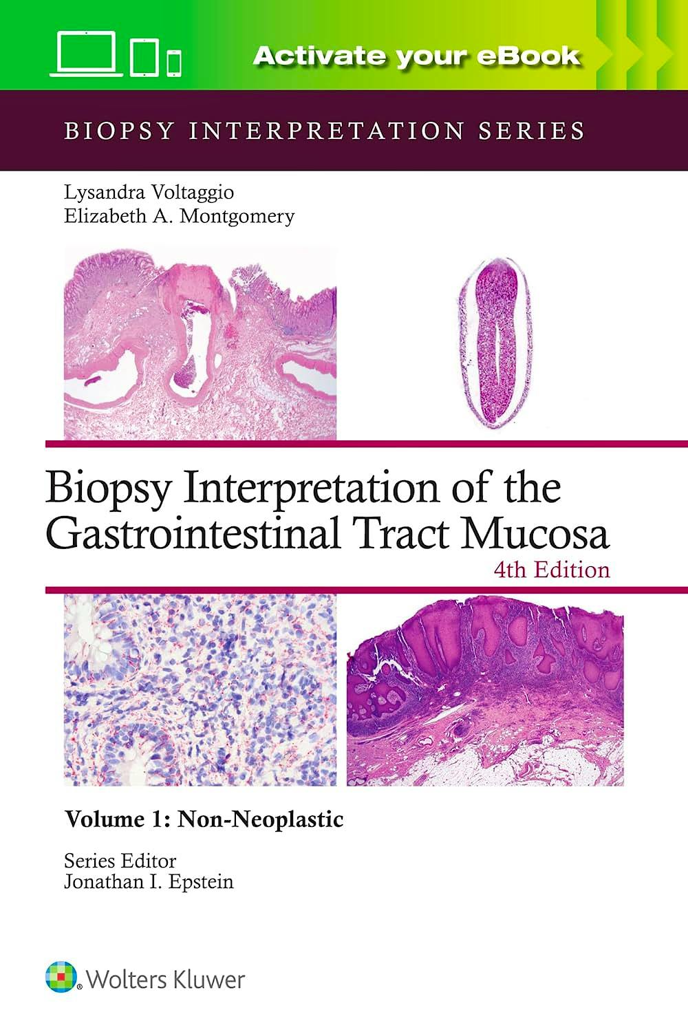 Portada del libro 9781975213664 Biopsy Interpretation of the Gastrointestinal Tract Mucosa, Vol. 1: Non-Neoplastic. Print + eBook with Multimedia