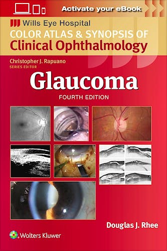 Glaucoma. Wills Eye Institute Atlas Series
