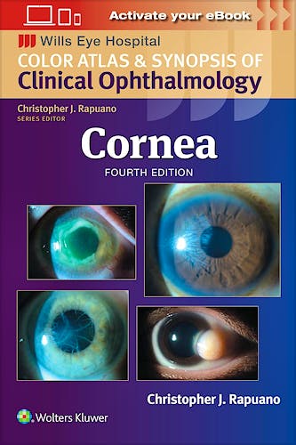 Cornea. Color Atlas and Synopsis of Clinical Ophthalmology. Wills Eye Hospital