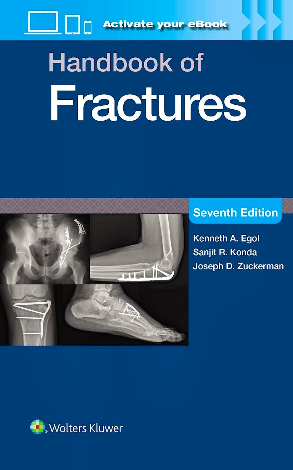 Portada del libro 9781975217990 Handbook of Fractures