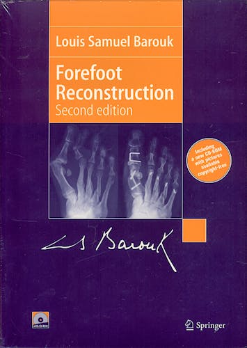Portada del libro 9782287252518 Forefoot Reconstruction