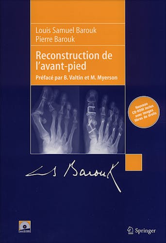 Portada del libro 9782287289446 Reconstruction de l´Avant-Pied