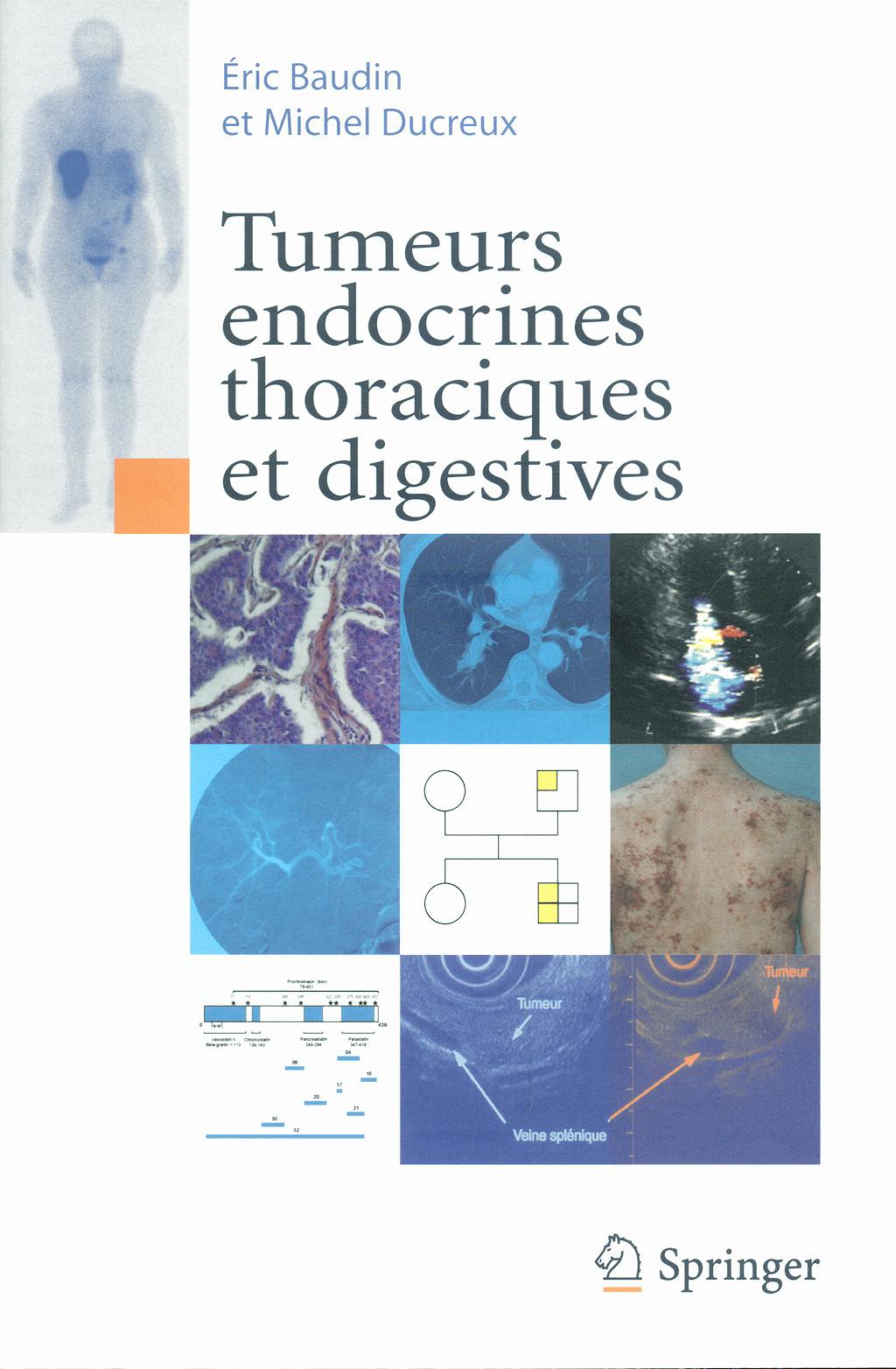Portada del libro 9782287355738 Tumeurs Endocrines Thoraciques Et Digestives