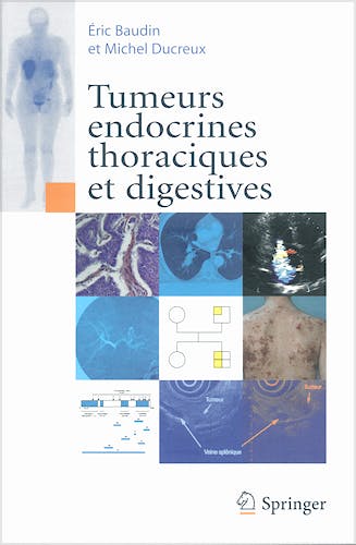Portada del libro 9782287355738 Tumeurs Endocrines Thoraciques Et Digestives