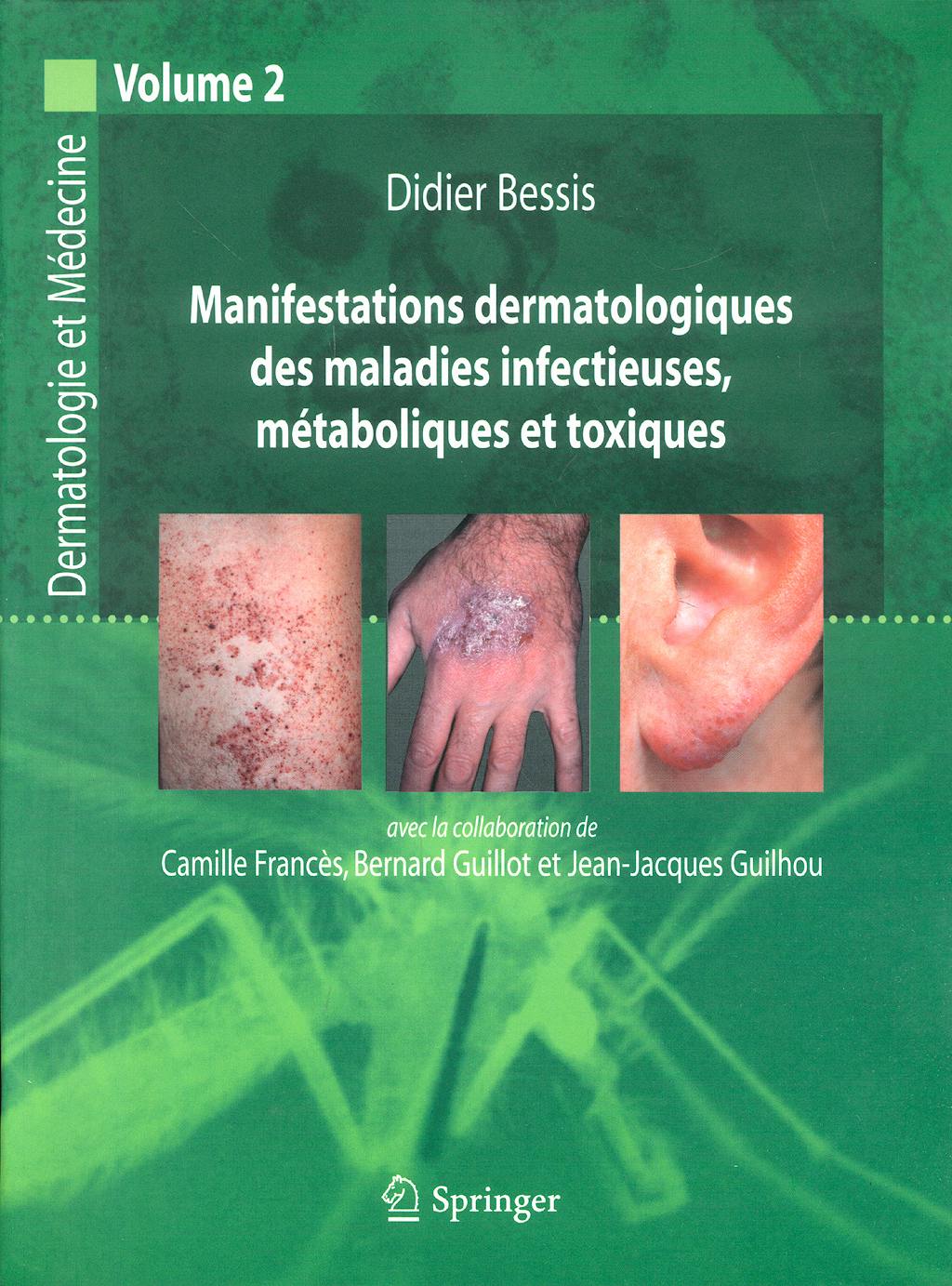 Portada del libro 9782287484933 Manifestations Dermatologiques Des Maladies Infetieuses Metaboliques