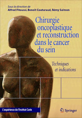 Portada del libro 9782287714757 Chirurgie Oncoplastique Et Reconstruction Dans Le Cancer Du Sein. Techniques Et Indications. L’experience de L’institut Curie