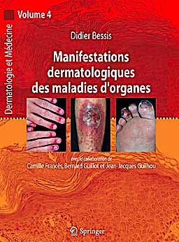 Portada del libro 9782287720727 Manifestations Dermatologiques Des Maladies D'organes (Dermatologie Et Medecine, Vol. 4)