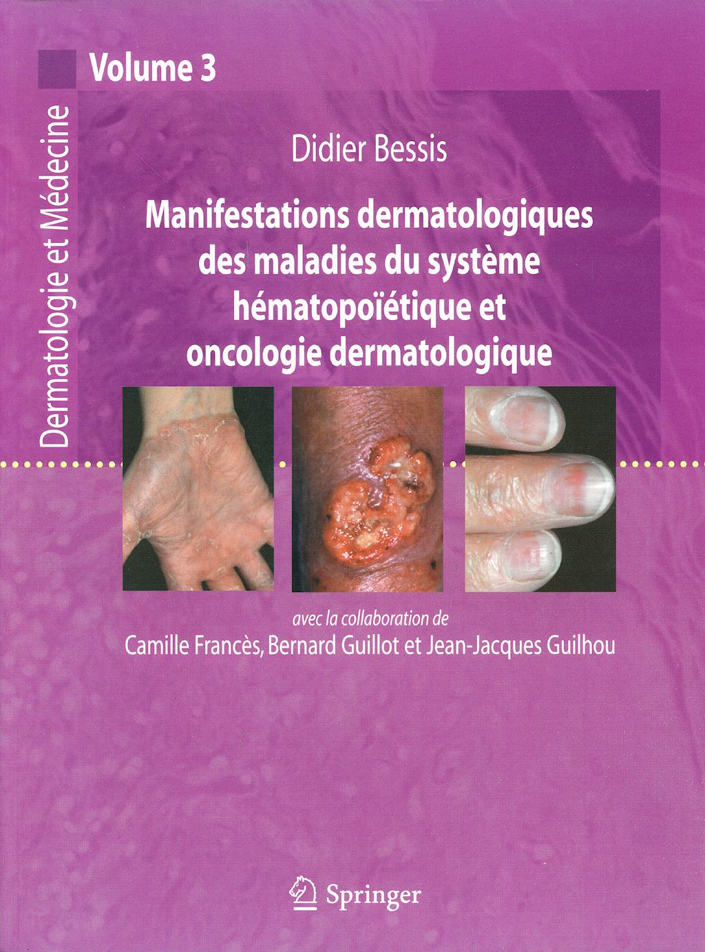 Portada del libro 9782287720918 Manifestations Dermatologiques Des Maladies Hemotoique Oncologie