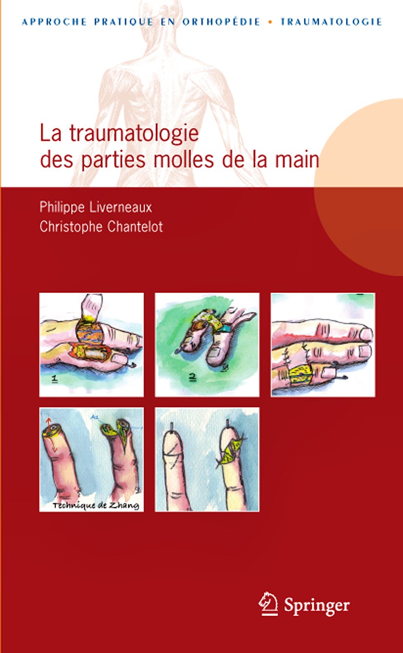 Portada del libro 9782287990670 La Traumatologie Des Parties Molles de la Main