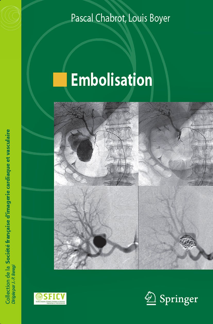 Portada del libro 9782287991691 Embolisation (Collection de la Societe Française D’imagerie Cardiaque Et Vasculaire)