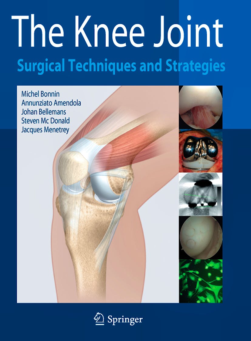 The Knee Joint. Surgical Techniques and Strategies