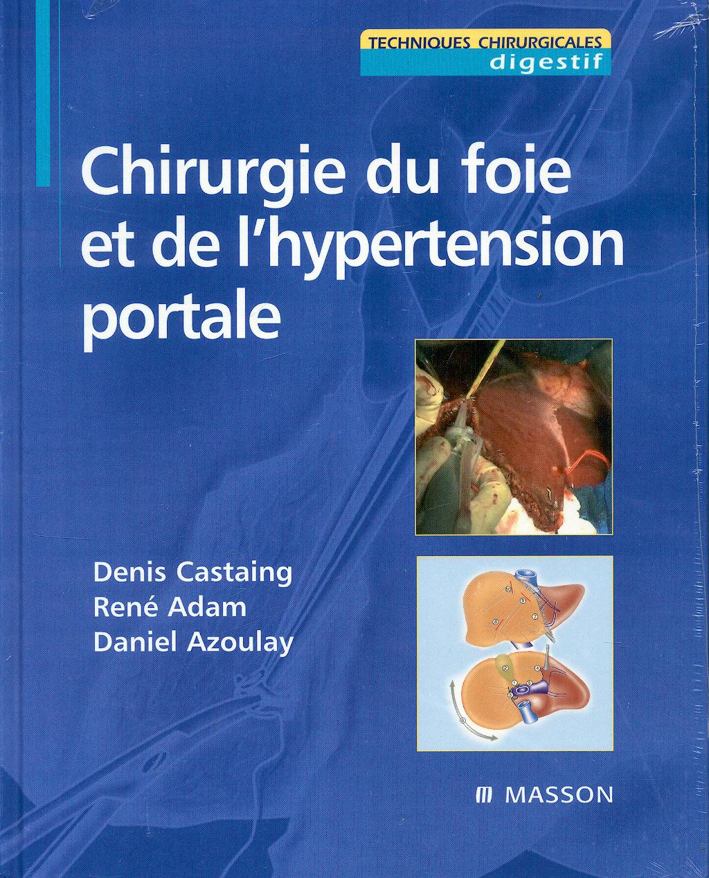 Portada del libro 9782294014970 Chirurgie Du Foie Et de L'hypertension Portale (Techniques Chirurgicales Digestif)