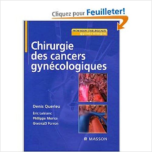 Portada del libro 9782294017230 Chirurgie Des Cancers Gynecologiques