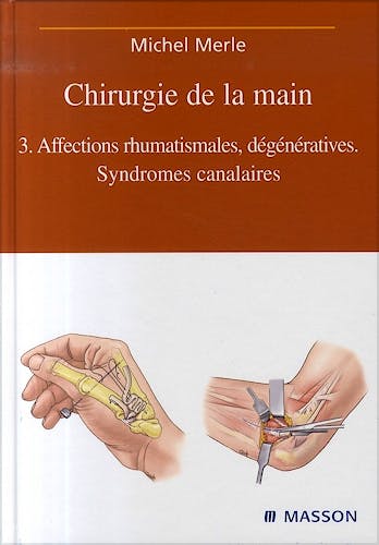 Portada del libro 9782294019111 Chirurgie de la Main: Tome 3, Affections Rhumatismales, Dégénératives. Syndromes Canalaires