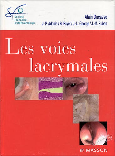 Portada del libro 9782294064395 Les Voies Lacrymales