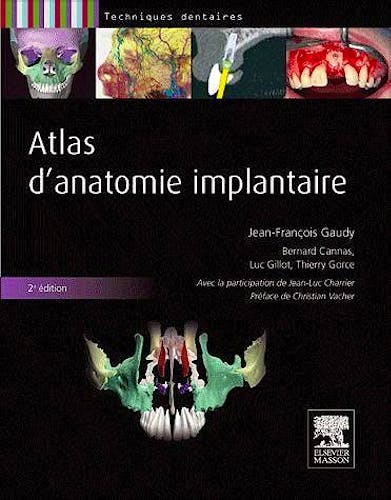 Portada del libro 9782294713798 Atlas d´Anatomie Implantaire
