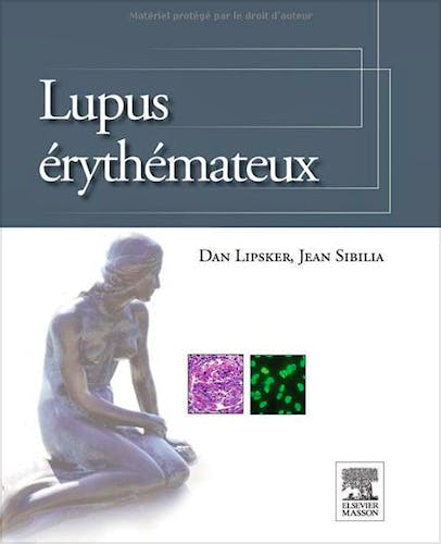 Portada del libro 9782294714474 Lupus Erythemateux