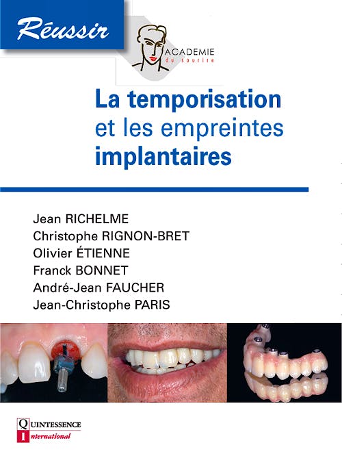 Portada del libro 9782366150124 La Temporisation Et Les Empreintes en Implantologie