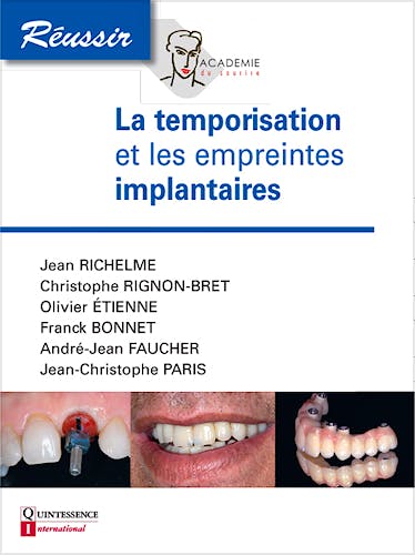 Portada del libro 9782366150124 La Temporisation Et Les Empreintes en Implantologie
