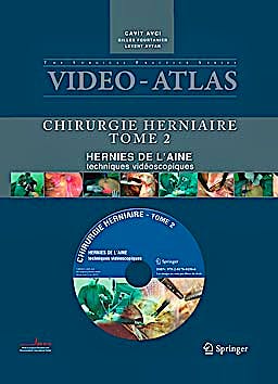 Portada del libro 9782817801506 Video Atlas Chirurgie Herniaire, Tome 2: Hernie de L'aine, Techniques Vidéoscopiques