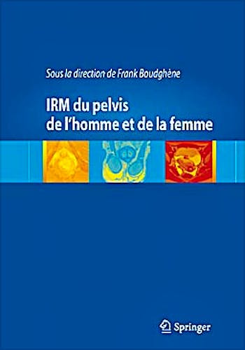 Portada del libro 9782817804279 Irm Du Pelvis de L’homme Et de la Femme