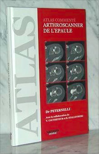 Portada del libro 9782840232018 Atlas Commenté Arthroscanner de l'Epaule