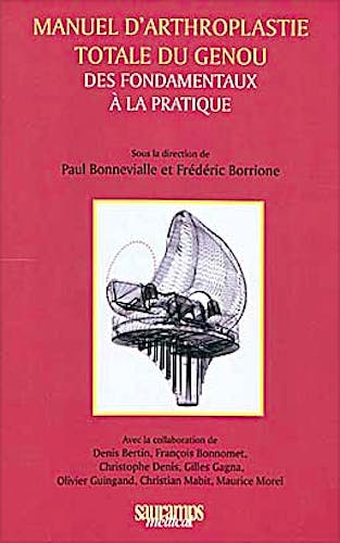 Portada del libro 9782840236474 Manuel D'arthroplastie Totale Du Genou. Des Fondamentaux À la Pratique