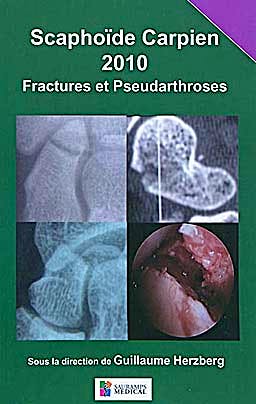Portada del libro 9782840236993 Scaphoïde Carpien 2010 Fractures Et Pseudarthroses