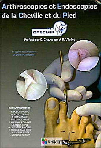 Portada del libro 9782840237068 Arthroscopies et Endoscopies de la Cheville et du Pied