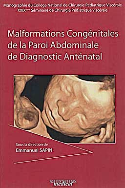 Portada del libro 9782840237082 Malformations Congenitales de la Paroi Abdominale de Diagnostic Antenatal