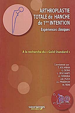 Portada del libro 9782840237174 Arthroplastie Totale de Hanche de 1ère Intention Expériences Cliniques