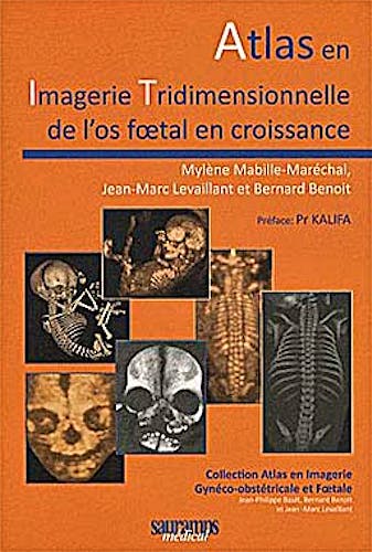 Portada del libro 9782840237181 Atlas en Imagerie Tridimensionnelle de L'os Foetal en Croissance