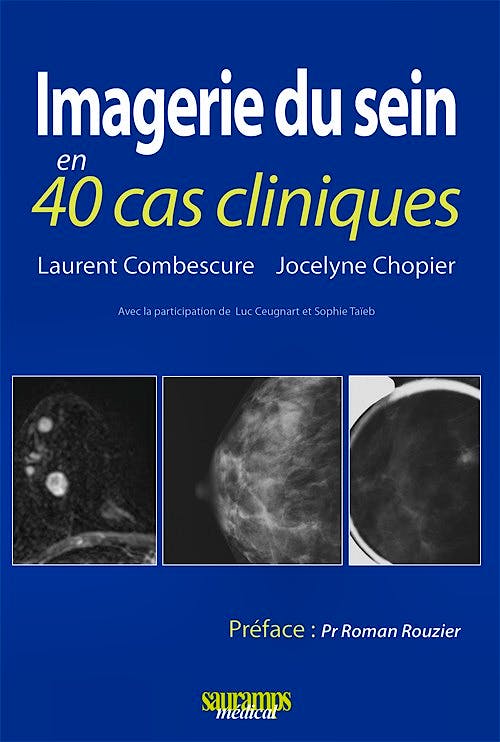 Portada del libro 9782840237235 Imagerie Du Sein en 40 Cas Cliniques