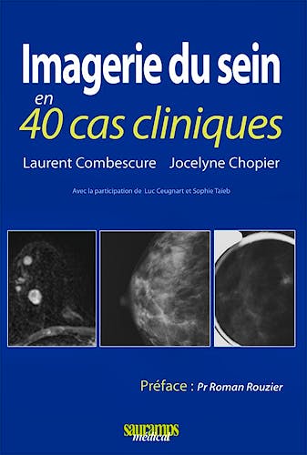 Portada del libro 9782840237235 Imagerie Du Sein en 40 Cas Cliniques