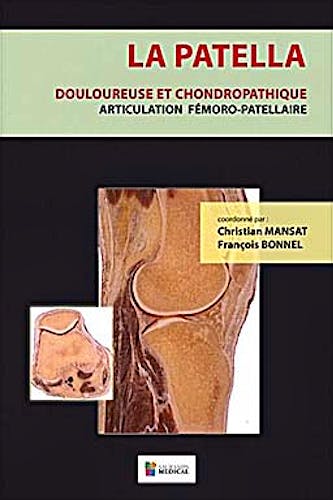 Portada del libro 9782840237297 La Patella. Douloureuse Et Chondropathique. Articulation Femoro-Patellaire