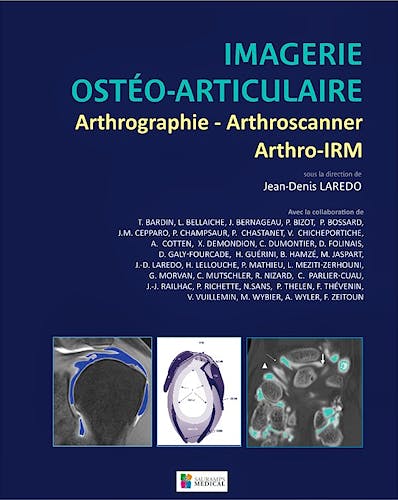 Portada del libro 9782840237433 Imagerie Osteo-Articulaire: Arthrographie - Arthroscanner - Arthro-Irm