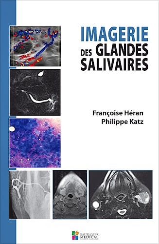 Portada del libro 9782840237457 Imagerie Des Glandes Salivaires