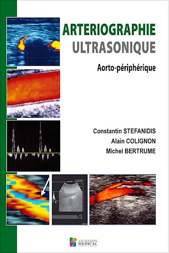 Portada del libro 9782840237488 Arteriographie Ultrasonique. Aorto Périphérique