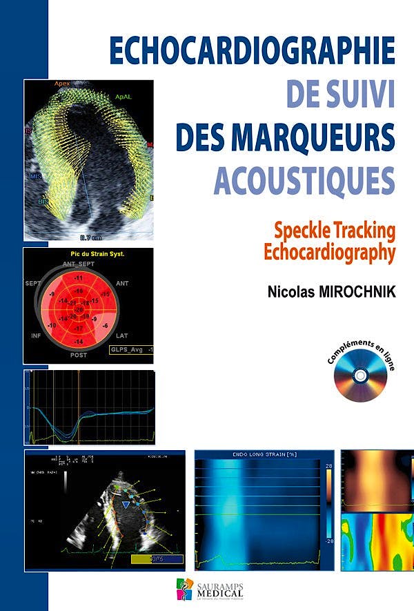 Portada del libro 9782840237631 Echocardiographie de Suivi Des Marqueurs Acoustiques